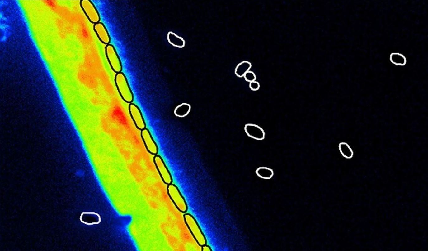 NanoSIMS imaging - Fungal hyphae, germinated cells and spores (white circles)   of the bacterium Bacillus subtilis (Photo: UFZ / ProVIS / Anja Worrich)